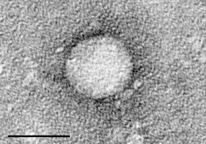 [Comment] Shortening treatment to accelerate hepatitis C elimination