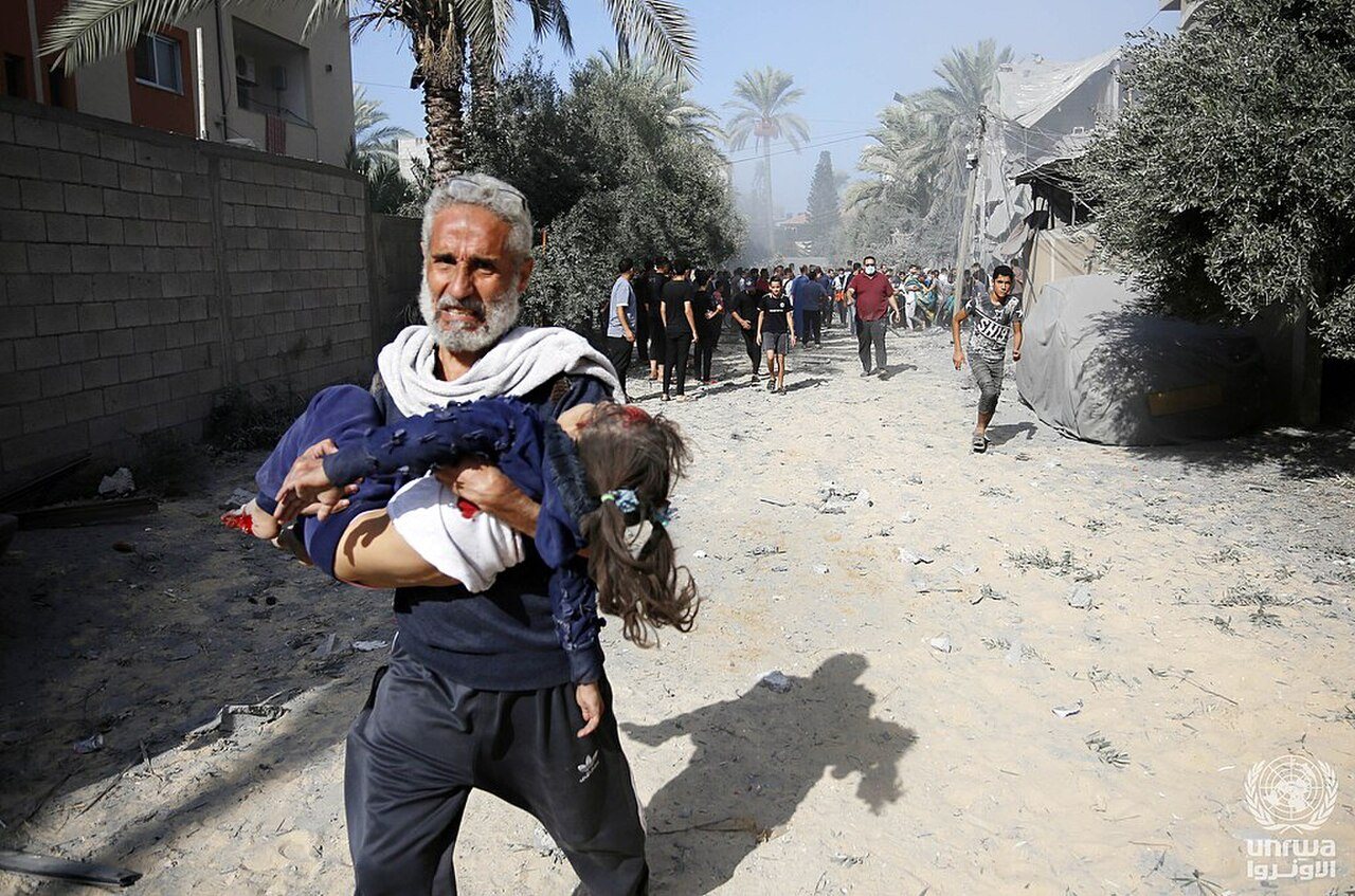 Palestinian injured by an Israeli airstrike on a house in Deir el-Balah, Gaza Strip
