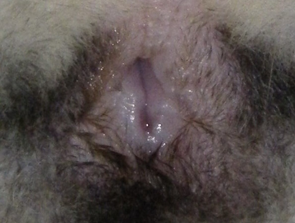 Vulva of a domestic cat
