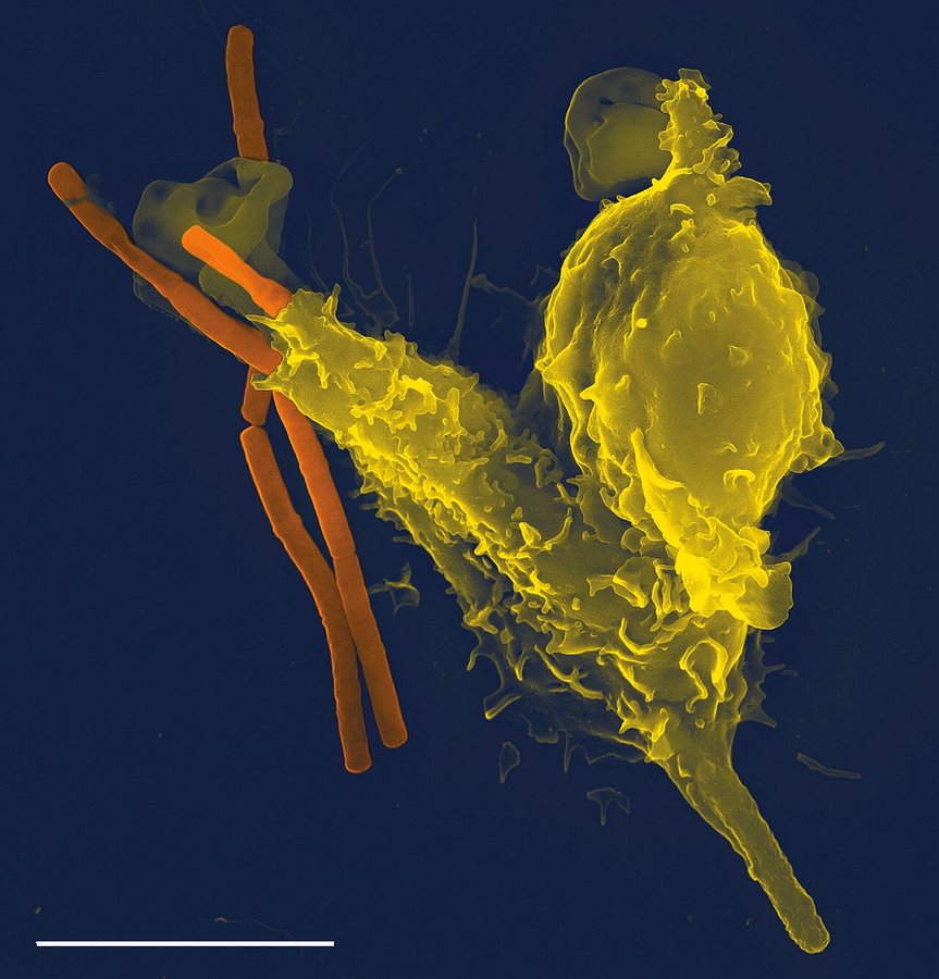 Could measuring immune health reshape medical care?