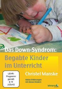 Das Down-Syndrom – Begabte Kinder im Unterricht