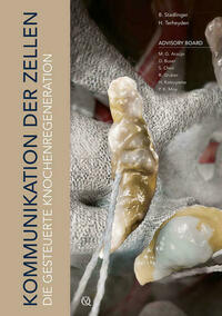 Die gesteuerte Knochenregeneration