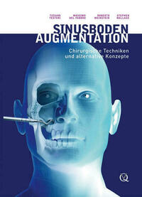 Sinusbodenaugmentation