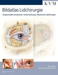 Bildatlas Lidchirurgie