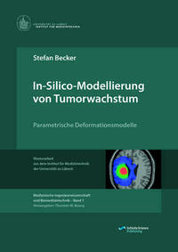 In-Silico-Modellierung von Tumorwachstum