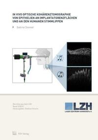 In vivo optische Kohärenztomographie von Epithelien an Implantatgrenzflächen und an den humanen Stimmlippen