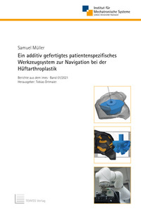 Ein additiv gefertigtes patientenspezifisches Werkzeugsystem zur Navigation bei der Hüftarthroplastik