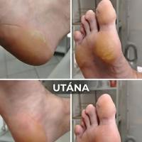 Pedichiură
