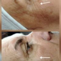 Tratament facial complet wellness 
