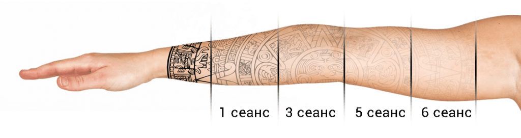 Видалення татуажу/тату