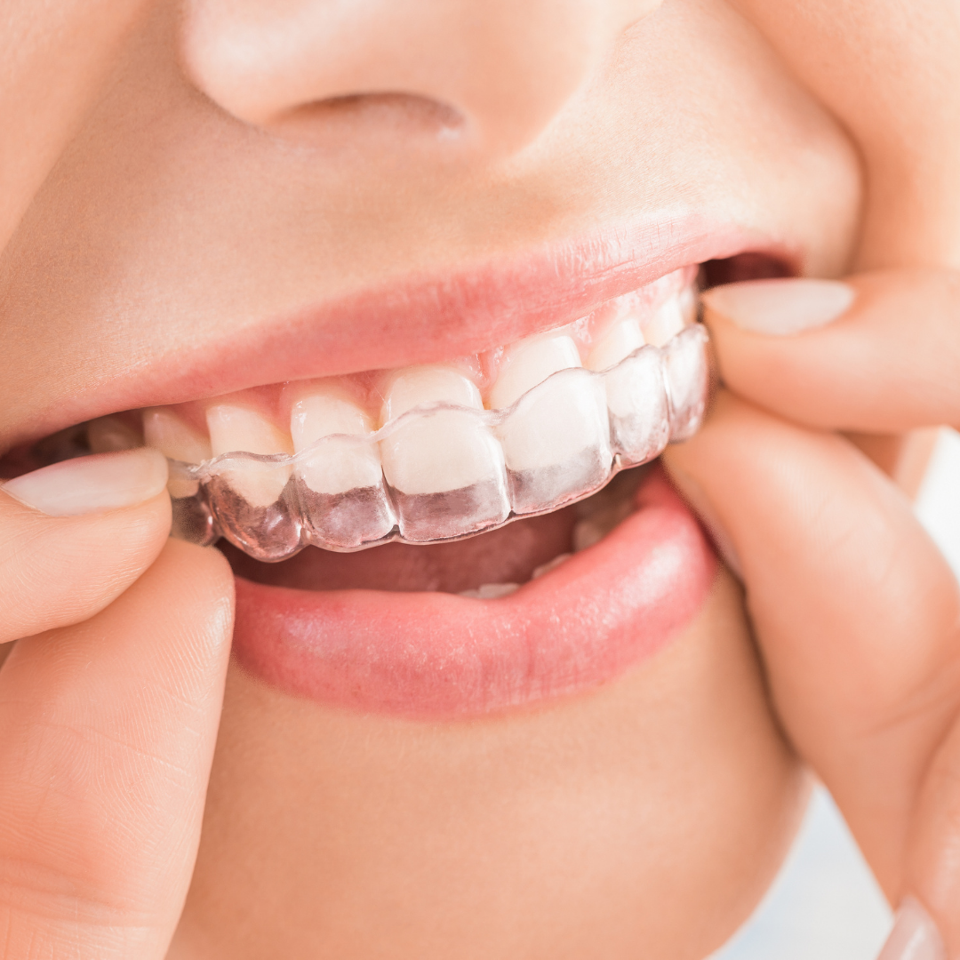 Implantološki center Slika trgovine