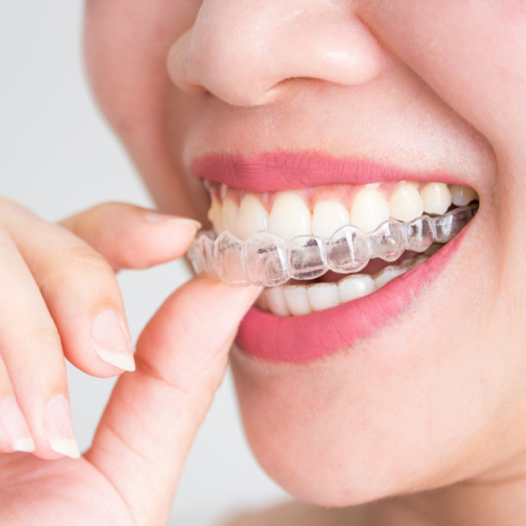 Ortodont ortodontija ambulanta Koper Slika trgovine