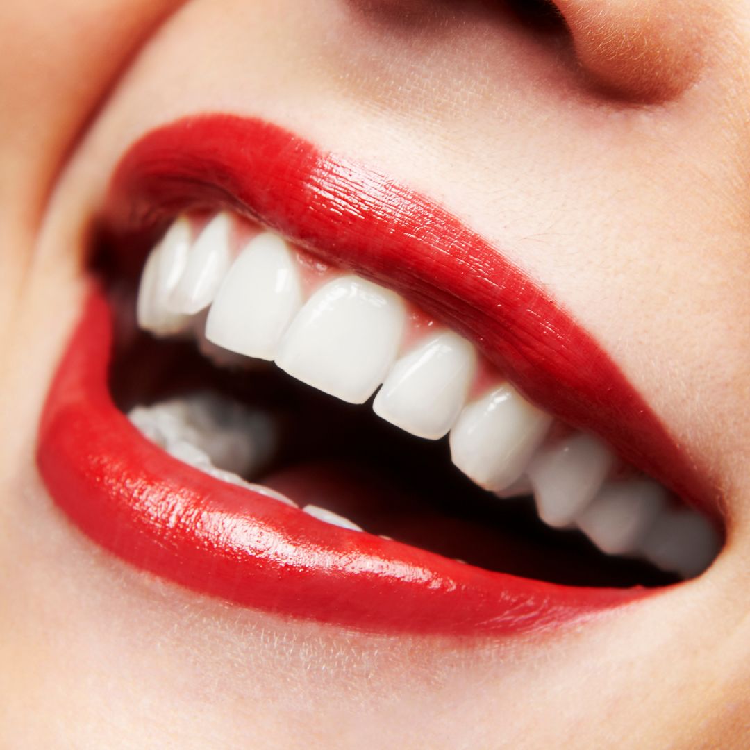 Top Smile Slika trgovine