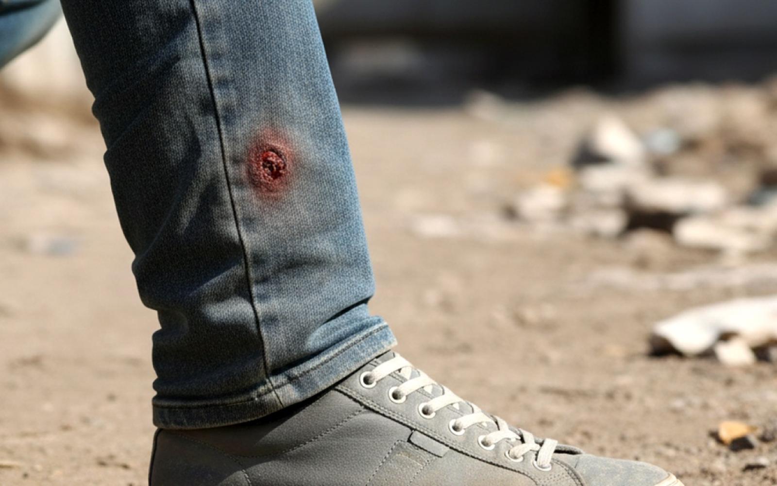 تصاعد الاعتداءات: شاب بإصابة حرجة برصاص الاحتلال، وآخرون يتعرضون لاعتداءات المستوطنين في الضفة الغربية