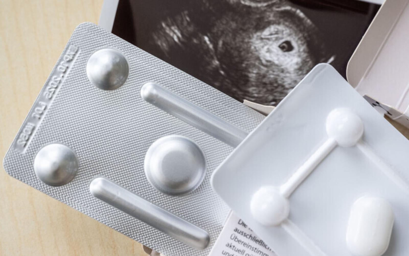 تينيسي تثير الجدل: مشروع قانون يعاقب الإجهاض بالإعدام ويحمل الأم مسؤولية القتل