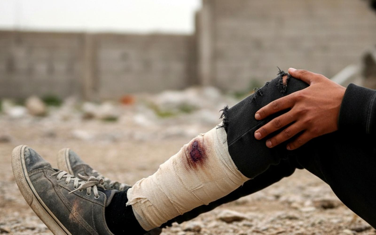 طفل فلسطيني يصاب بالرصاص المطاطي خلال اقتحام إسرائيلي عنيف لبلدة عناتا شمال شرق القدس