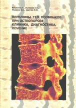 Переломы тел позвонков при остеопорозе. Клиника, диагностика, лечение | Osteoporotic vertebral compression fractures: Clinic, diagnosis, treatment