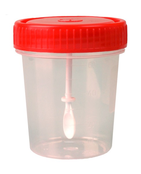 Sterile 60ml Specimen Containers with Spoon (10 Pack)