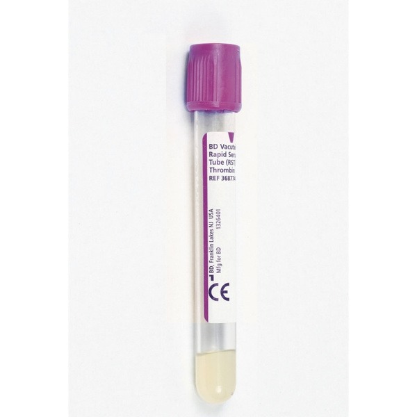 EDTA K3 Vacuum Blood Collection Tubes (4ml, 100/pack)