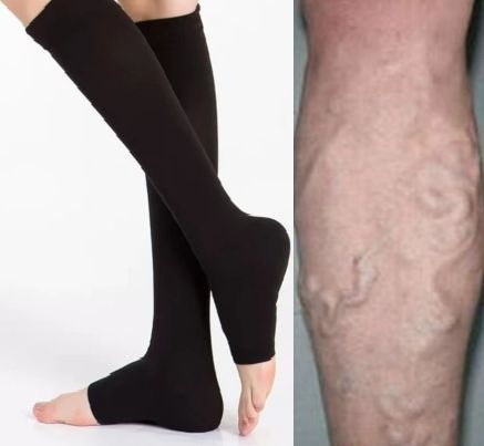 Compression Socks for Varicose Veins (1 Pair)