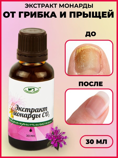 Mondo Extract Dietary Supplement (30ml) - Rodniki Sibiri