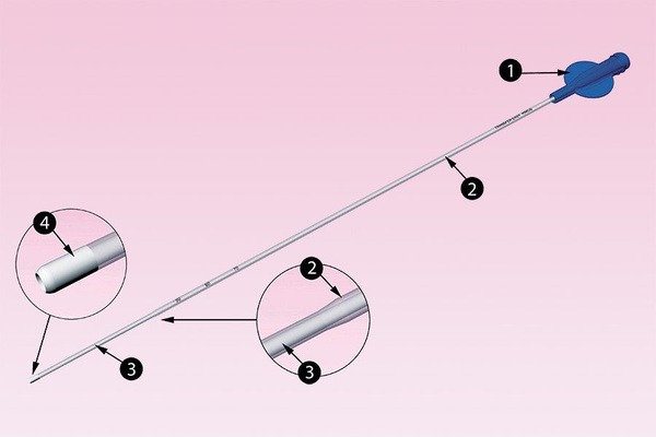 Embryo Transfer Catheter: Easy &amp; Efficient
