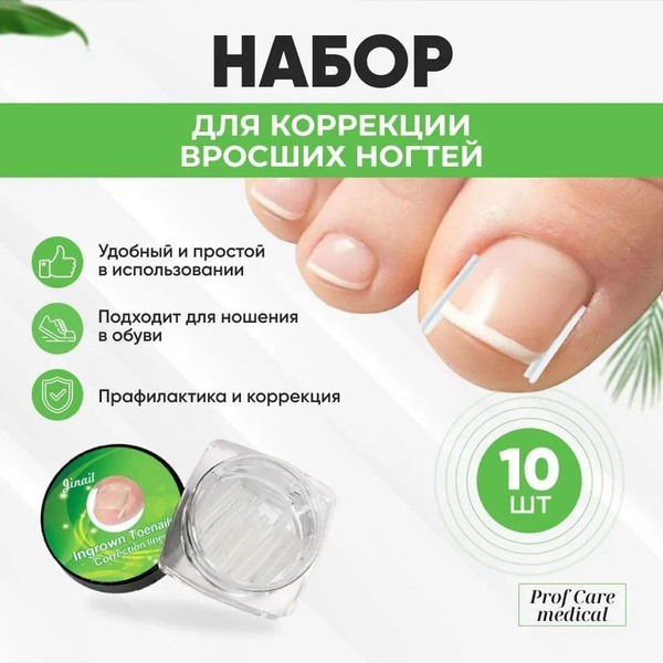 Ingrown Toenail Corrector Kit (10 Pieces)