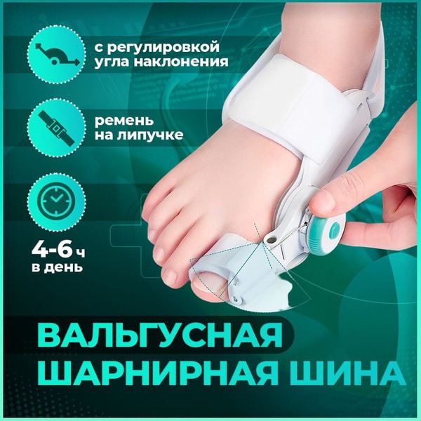 Valgus Bunion Corrector with Adjustable Angle: Toe Straightener & Support