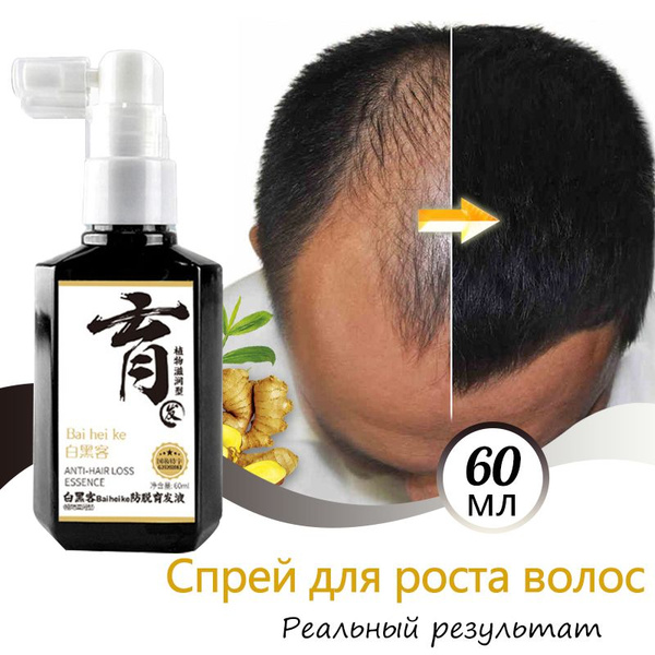 Hair Growth Spray &amp; Anti-Hair Loss Treatment (60ml) - Natural Extracts