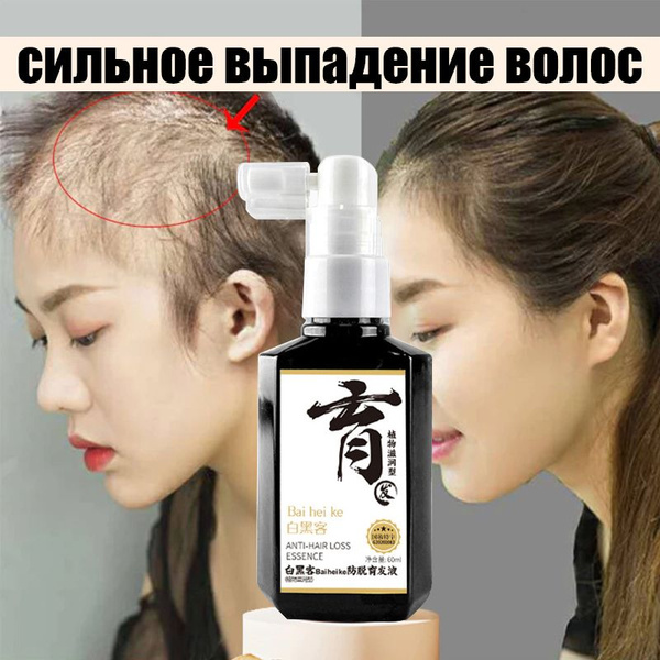 Hair Growth &amp; Thickness Serum: Anti-Hair Loss &amp; Thinning Treatment (60ml)