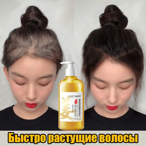 Ginger Shampoo for Hair Growth &amp; Thickness: Prevents Breakage &amp; Hair Loss (500ml)