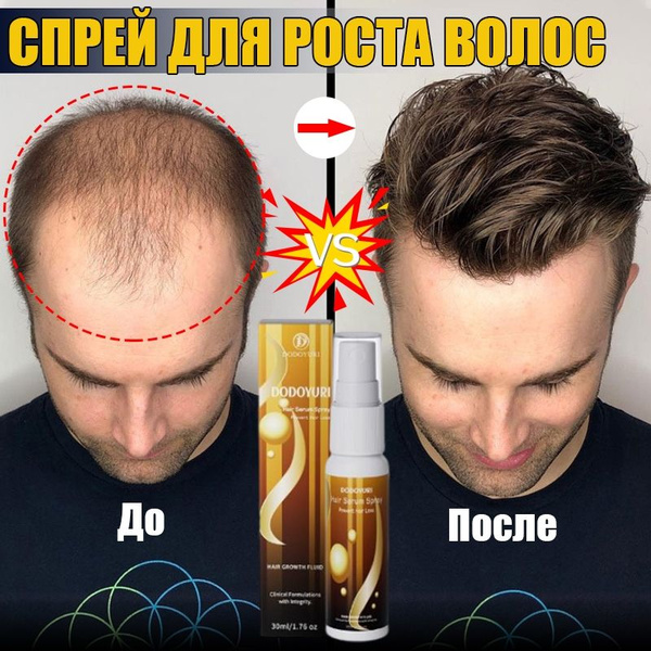Hair Growth Spray & Hair Loss Treatment - DODOYURI (30ml)