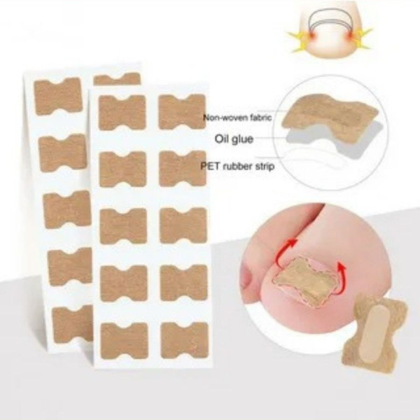 Ingrown Toenail Patches: Relief &amp; Correction