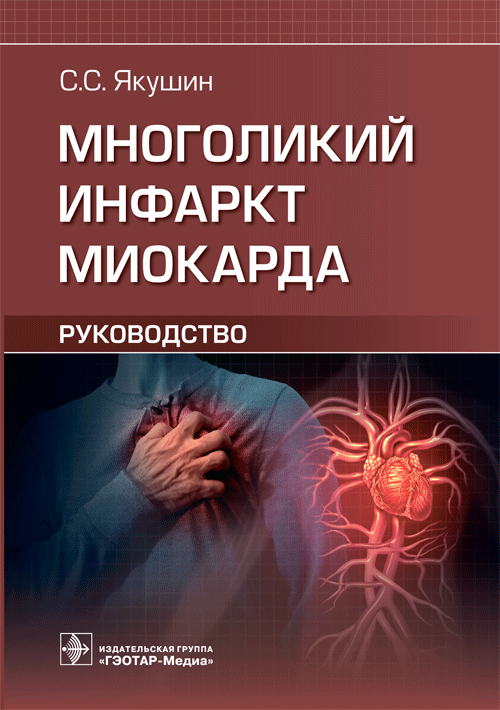 Многоликий инфаркт миокарда | The Multifaceted Myocardial Infarction
