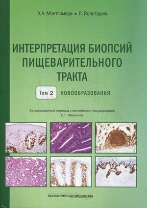 Интерпретация биопсий пищеварительного тракта. Руководство. Том 2: Новообразования | Interpretation of Digestive Tract Biopsies. Guide. Volume 2: Neoplasms