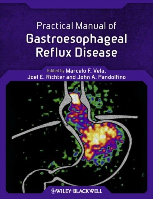 Practical Manual of Gastroesophageal Reflux Disease | Practical Manual of Gastroesophageal Reflux Disease
