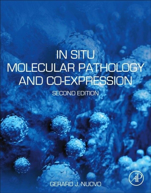 In Situ Molecular Pathology And Co-Expression Analyses | In Situ Molecular Pathology and Co-Expression Analyses