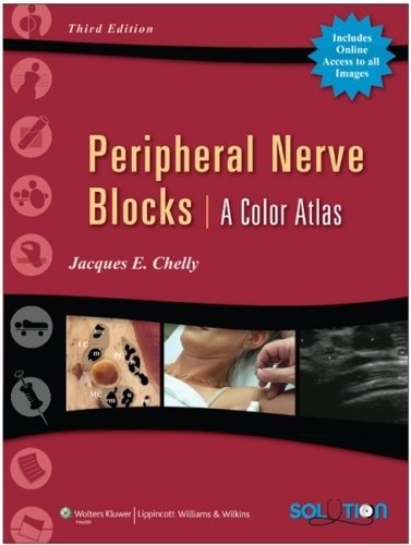 Peripheral Nerve Blocks A Color Atlas 3/e | Peripheral Nerve Blocks: A Color Atlas, 3rd Edition