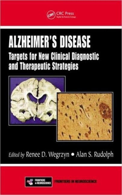 Болезнь Альцгеймера | Alzheimer's Disease: Targets for New Clinical, Diagnostic, and Therapeutic Strategies
