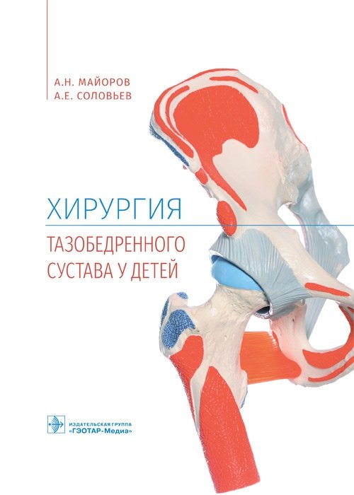 Хирургия тазобедренного сустава у детей | Pediatric Hip Joint Surgery