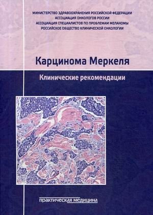 Карцинома Меркеля. Клинические рекомендации. Гриф Министерства Здравоохранения | Merkel Cell Carcinoma: Clinical Recommendations