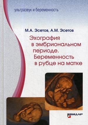 Эхография в эмбриональном периоде. Беременность в рубце на матке | Embryonic Period Echography: Pregnancy in a Uterine Scar