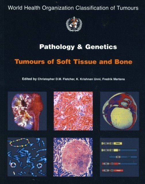 WHO Classification of Tumours Pathology & Genetics of Tumours of the Soft Tissue & Bone | WHO Classification of Tumours: Pathology and Genetics of Soft Tissue and Bone Tumours