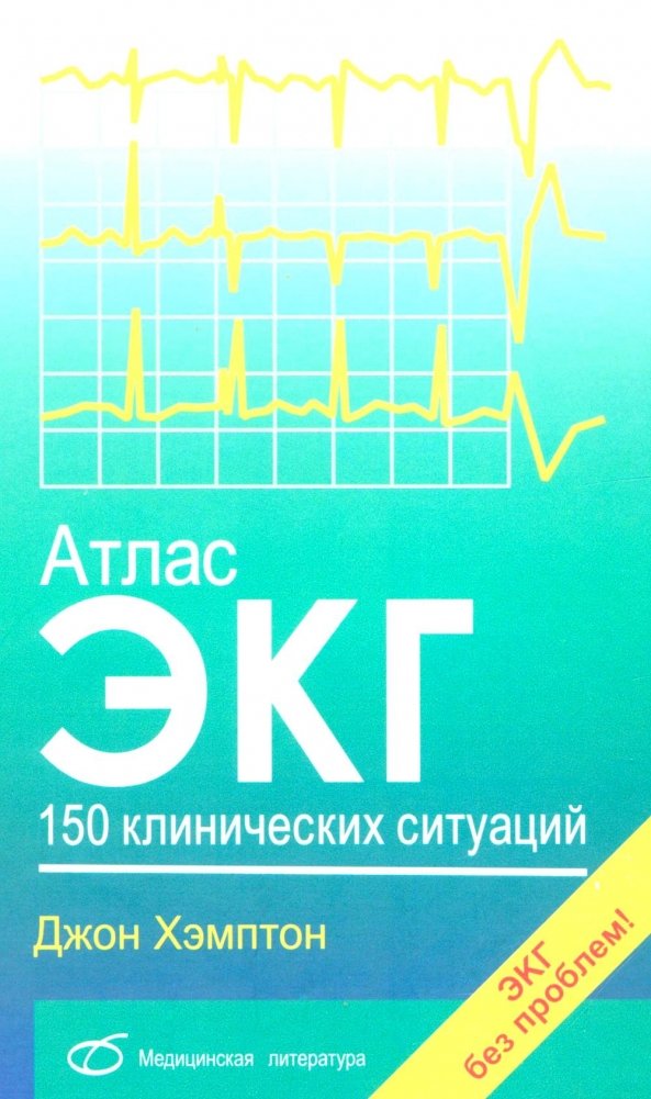 Атлас ЭКГ: 150 клинических ситуаций | ECG Atlas: 150 Clinical Situations