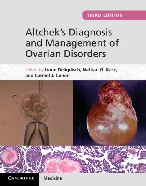 Altchek's Diagnosis and Management of Ovarian Disorders | Altchek's Diagnosis and Management of Ovarian Disorders