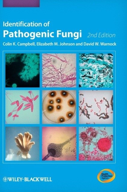 Идентификация патогенных грибов | Identification of Pathogenic Fungi