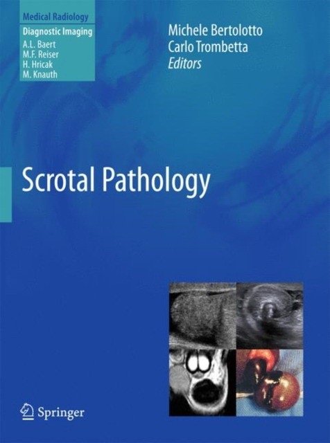 Патология мошонки | Scrotal Pathology