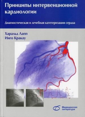 Принципы интервенционной кардиологии. Диагностическая и лечебная катетеризация сердца. Руководство | Principles of Interventional Cardiology: Diagnostic and Therapeutic Heart Catheterization Guide