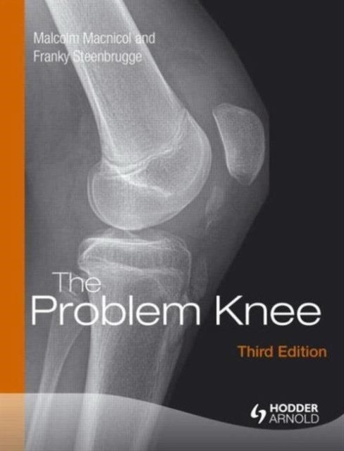 The Problem Knee, Third Edition | The Problem Knee, Third Edition