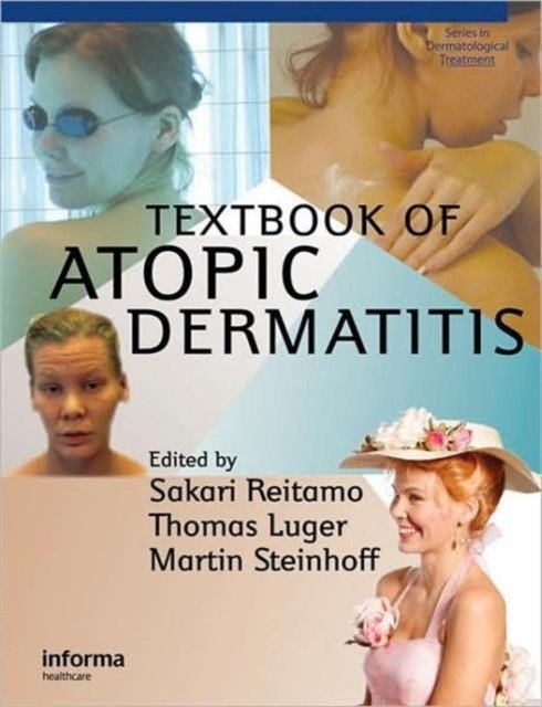 Textbook Atopic Dermatitis | Textbook on Atopic Dermatitis